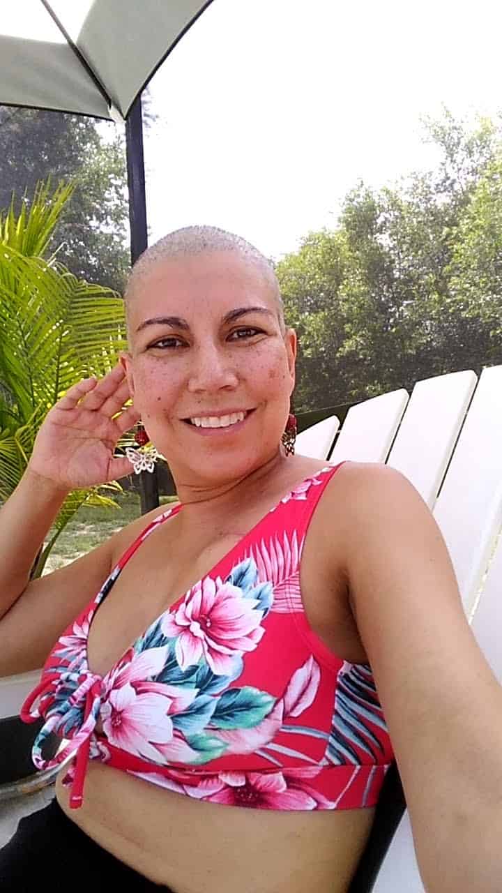 Woman with a bald head smiling while sitting outdoors in a floral swimsuit top.